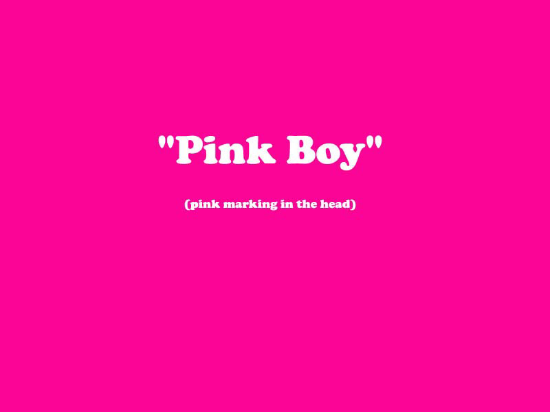 X_BOY_PINK